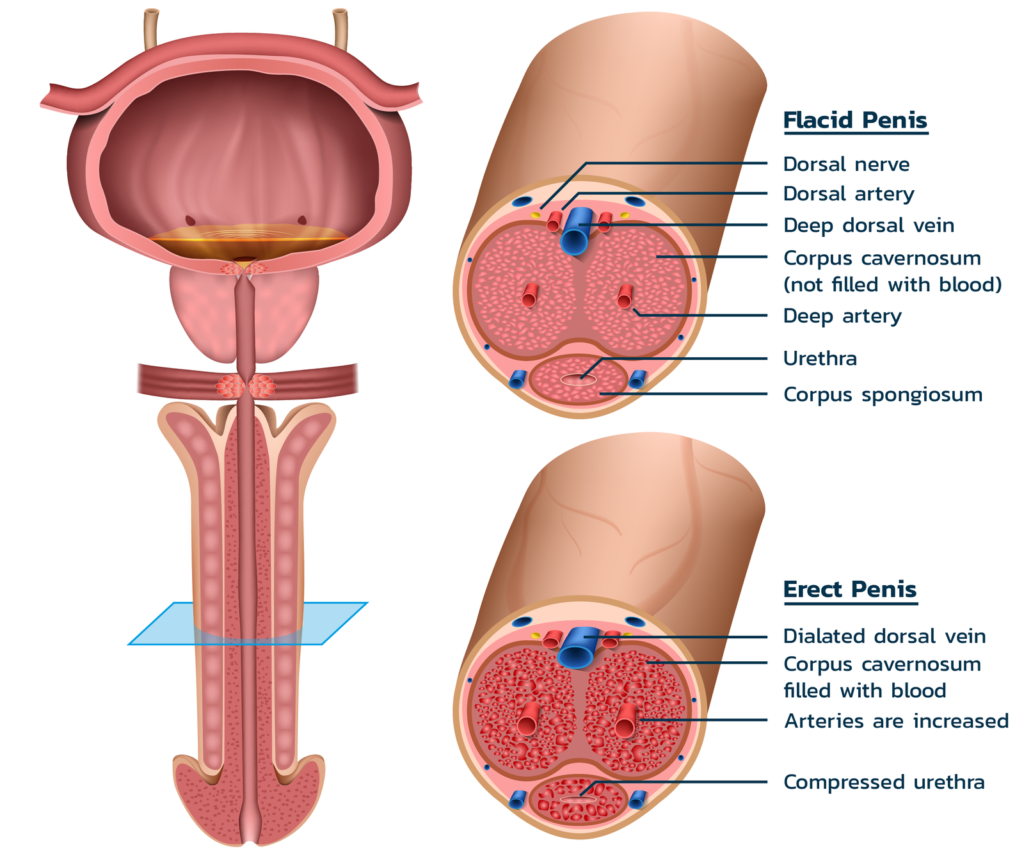 Venous Leak